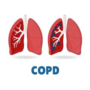 COPD